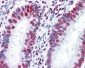 HNRPM / HNRNPM Antibody (clone 3F7)