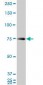 HNRPM / HNRNPM Antibody (clone 3F7)