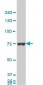 HNRPM / HNRNPM Antibody (clone 3F7)
