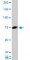 HNRPM / HNRNPM Antibody (clone 3F7)