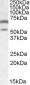 CAMK2A / CaMKII Alpha Antibody (Internal)