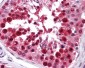 HNRNP-E2 / PCBP2 Antibody (clone 5F12)