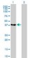 HNRNP-E2 / PCBP2 Antibody (clone 5F12)