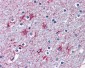 P2RX7 / P2X7 Antibody (N-Terminus)