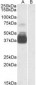 P2RX7 / P2X7 Antibody (N-Terminus)