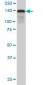 SAFB1 / SAFB Antibody (clone 5A11)