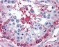 GPI Antibody (N-Terminus)