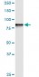 GOK / STIM1 Antibody (clone 5A2)