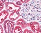 BCAP31 / BAP31 Antibody (C-Terminus)