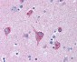 STXBP1 / MUNC18-1 Antibody (C-Terminus)