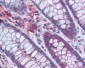 G3BP1 / G3BP Antibody (clone 2F3)