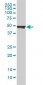 KRT20 / CK20 / Cytokeratin 20 Antibody (clone 2G3-1C8)