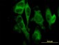 Gasdermin D / GSDMD Antibody (clone 3F12-1B2)