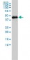 Gasdermin D / GSDMD Antibody (clone 3F12-1B2)