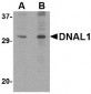 DNAL1 Antibody (C-Terminus)
