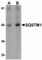 SQSTM1 Antibody (C-Terminus)