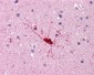 BCAS1 / NABC1 Antibody (C-Terminus)