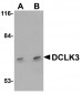 DCLK3 / CLR Antibody (N-Terminus)