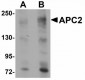 APCL / APC2 Antibody (Internal)