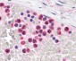 TLR4 Antibody (C-Terminus)