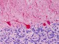 CARMA1 / CARD11 Antibody