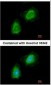 GSN / Gelsolin Antibody