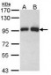GSN / Gelsolin Antibody