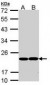GPX1 / Glutathione Peroxidase Antibody