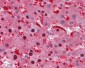 IDH1 / IDH Antibody