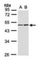 IDH1 / IDH Antibody