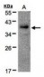 RAD51AP1 Antibody