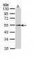 PLIN2 / ADFP / Adipophilin Antibody