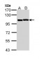 ACTN2 Antibody