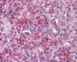 PAK1 Antibody