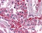 BIRC3 / cIAP2 Antibody