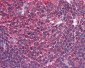 BIRC3 / cIAP2 Antibody