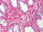 SLC5A3 / SMIT2 Antibody (aa221-270)