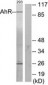 AHR Antibody (aa2-51)