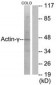ACTG2 Antibody (aa1-50)