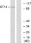 ST14 / Matriptase Antibody (aa10-59)