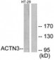 ACTN3 Antibody (aa1-50)