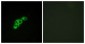 FSH Receptor / FSHR Antibody (aa278-327)