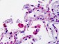 SMO / Smoothened Antibody (aa68-117)