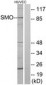 SMO / Smoothened Antibody (aa68-117)