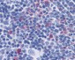 IL17 Antibody (clone TC11-18H10)