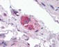 CYP26B1 Antibody (Internal)