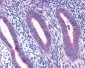 RPL22 / L22 Antibody (C-Terminus)