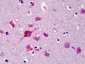 SLC35D1 Antibody (N-Terminus)