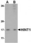 HINT / HINT1 Antibody (Internal)