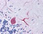 TTBK1 Antibody (C-Terminus)